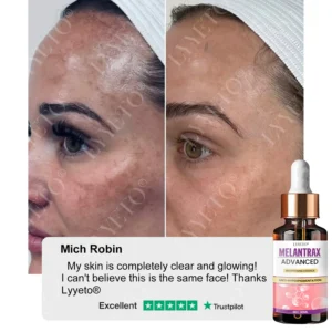 MelantraX Advanced Brightening Essence - Image 4