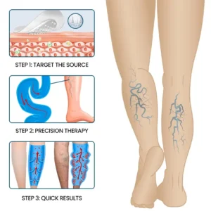 VeinFlow Microneedle Repair Patch - Image 10