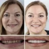 Premium Dentures