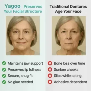 Full Denture with Strong Suction - Image 7