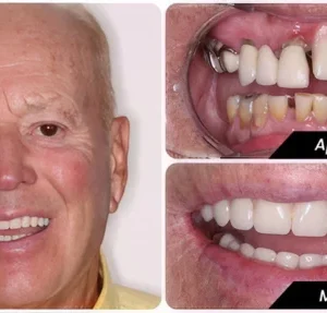 Bamboo Charcoal Whitening Toothpaste - Image 7