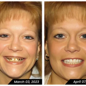 Bamboo Charcoal Whitening Toothpaste - Image 5