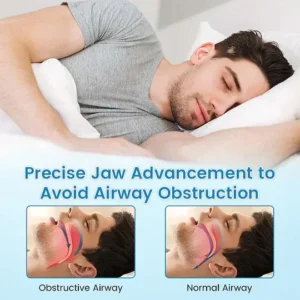 Adjustable Anti-Snoring Mouthpiece Universal Size - Image 3