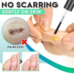 ActiveRelief One Step Corn Remover - Image 7