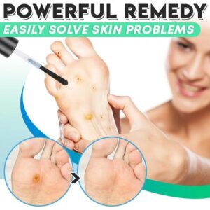 ActiveRelief One Step Corn Remover - Image 5