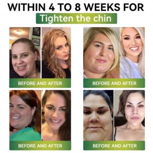 Mayo Clinic Recommended I Official Store | Nano Microneedle Patch with Collagen Peptides &Matrixyl 3000｜Solution-Obesity,Cardiovascular Diseas, Diabetes, Sleep Apnea, Joint Problems and More｜7-Day Results｜Needle-Free Applicationwith - Image 10