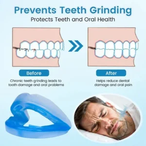 Adjustable Anti-Snoring Mouthpiece Universal Size - Image 7