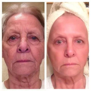 Pro-Collagen and Ceramide Lifting Ampoule Serum - Image 4