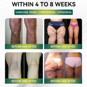 Mayo Clinic Recommended I Official Store | Nano Microneedle Patch with Collagen Peptides &Matrixyl 3000｜Solution-Obesity,Cardiovascular Diseas, Diabetes, Sleep Apnea, Joint Problems and More｜7-Day Results｜Needle-Free Applicationwith - Image 9