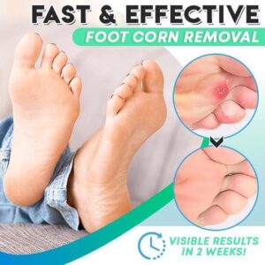 ActiveRelief One Step Corn Remover - Image 2
