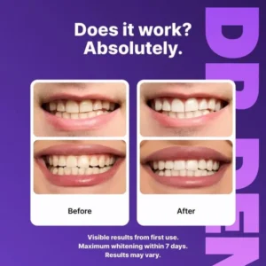 🦷7D Wisdom Tooth Whitening – Gentle, effective dental care with sea salt for bright white teeth 💎 - Image 3