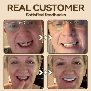 🎈🎈- 𝐏𝐫𝐞𝐦𝐢𝐮𝐦 𝐃𝐞𝐧𝐭𝐮𝐫𝐞 - Image 6