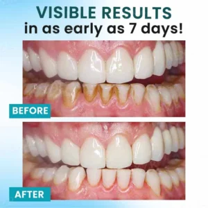 Oral Calculus Suppressant - Image 4