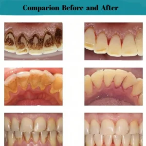 Oral Calculus Suppressant - Image 5