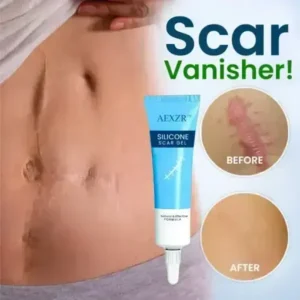 Silicone Scar Gel - Image 2