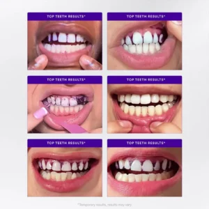 Whitening Strips - Image 7