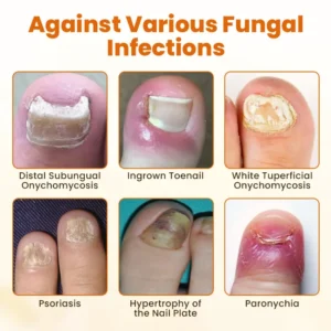 FungiBee Advanced Nail Repair Spray - Image 3