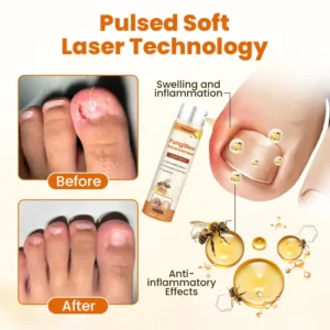 FungiBee Advanced Nail Repair Spray - Image 6