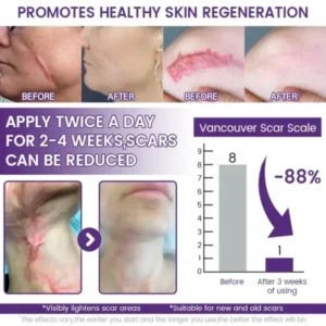 ReGenScar Stem Cell Scar Gel - Image 3