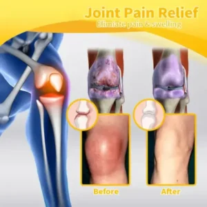 Bee Venom Advanced Joint and Bone Therapy Cream - Image 9