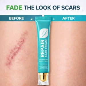 🌿Alisanda Scar Repair Cream|Treats Old and New Scars, Burns and More - Image 2