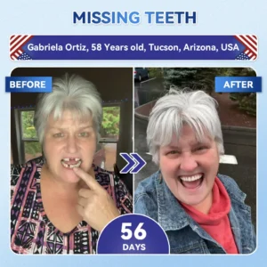 🦷 Tideglusib Fast‑Dissolving Tooth & Gum Repair Oral Strips ✨ - Image 3