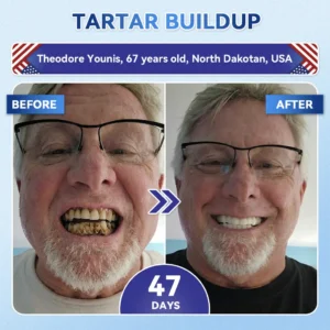 🦷 Tideglusib Fast‑Dissolving Tooth & Gum Repair Oral Strips ✨ - Image 5