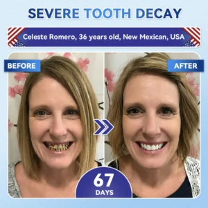 🦷 Tideglusib Fast‑Dissolving Tooth & Gum Repair Oral Strips ✨ - Image 6