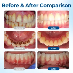 GumHoney Oral Repair Drops - Image 3