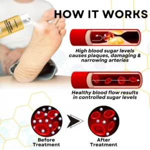 Bee Venom Diabetic Foot Treatment Spray - Image 6