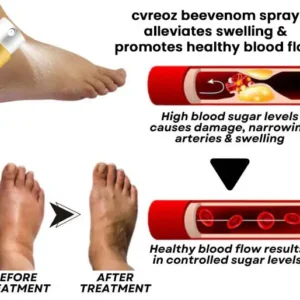 Bee Venom Diabetic Foot Treatment Spray - Image 8