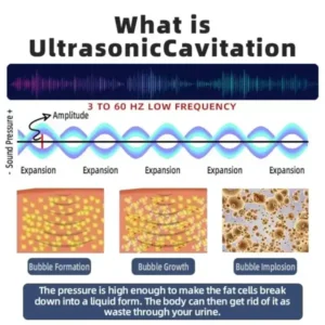 Ultrasonic Fat Blasting & Far Infrared Blood Sugar Balancing Detox Wristband - Image 6