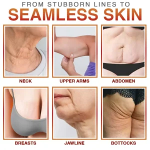 Anti-Cellulite Microneedle Patch - Image 2
