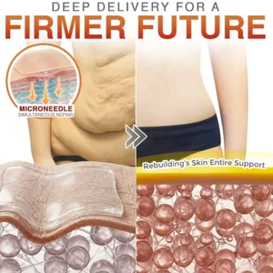 Anti-Cellulite Microneedle Patch - Image 4