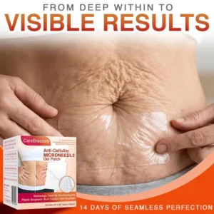 Anti-Cellulite Microneedle Patch - Image 6