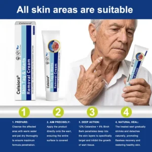 Targeted Skin Tag & Wart Removal Cream – Time-Released Phyto-Exfoliant (12% Celandine ) & Bio-Active Terpene Viral-Inhibitor (8% Thuja)