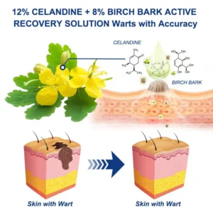 Targeted Skin Tag & Wart Removal Cream – Time-Released Phyto-Exfoliant (12% Celandine ) & Bio-Active Terpene Viral-Inhibitor (8% Thuja) - Image 5