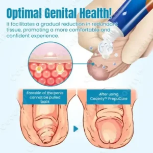 Foreskin Corrector Gel - Image 3