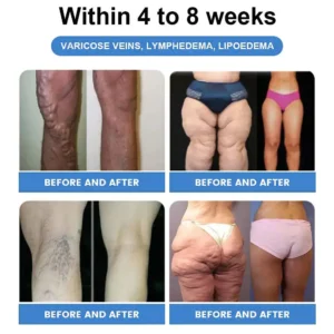𝑀𝑎𝑦𝑜 𝐶𝑙𝑖𝑛𝑖𝑐 𝑅𝑒𝑐𝑜𝑚𝑚𝑒𝑛𝑑𝑒𝑑 | 𝑂𝑓𝑓𝑖𝑐𝑖𝑎𝑙 𝑆𝑡𝑜𝑟𝑒 | SLIMMING & HEALTHCARE DROPS - 👨‍⚕️𝑂𝑏𝑒𝑠𝑖𝑡𝑦,𝐶𝑎𝑟𝑑𝑖𝑜𝑣𝑎𝑠𝑐𝑢𝑙𝑎𝑟 𝐷𝑖𝑠𝑒𝑎𝑠, 𝐷𝑖𝑎𝑏𝑒𝑡𝑒𝑠, 𝑆𝑙𝑒𝑒𝑝 𝐴𝑝𝑛𝑒𝑎, 𝐽𝑜𝑖𝑛𝑡 𝑃𝑟𝑜𝑏𝑙𝑒𝑚𝑠 𝑎𝑛𝑑 𝑀𝑜𝑟𝑒 - Image 10