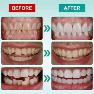 𝗜𝗻𝘀𝘁𝗮𝗻𝘁 𝗦𝘁𝗶𝗰𝗸-𝗼𝗻 𝗗𝗲𝗻𝘁𝗮𝗹 𝗩𝗲𝗻𝗲𝗲𝗿𝘀 - Image 8