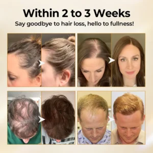 CollagenGrow Peptides Hair Growth Spray - Image 3