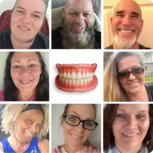 Ends Today: 75% OFF! Full Denture with Strong Suctiond Custom-Fit Full Functional Dentures🦷 - Image 10