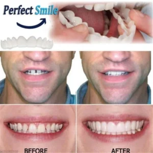 FLASH SALE: Fix Your Smile in 30 Seconds — 👨‍⚕Adjustable SnapOn Dentures😁 - Image 8