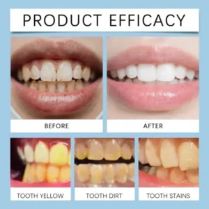 Feimuko Tooth Defense Serum with Nano Hydroxyapatite for Teeth Whitening and Deep Cleaning - Image 8