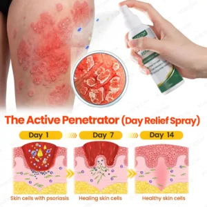 Psoriasis Day & Night Repair System - 100% Steroid-Free Relief Duo for Plaques, Scaling & Itch - Image 2