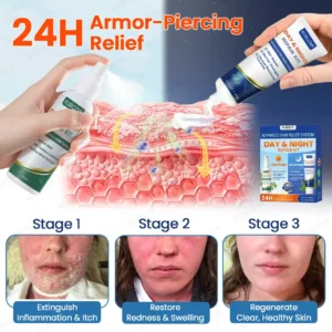 Psoriasis Day & Night Repair System - 100% Steroid-Free Relief Duo for Plaques, Scaling & Itch - Image 6
