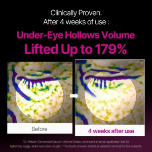 ✨ LAST DAY BUY 1 GET 1 FREE✨Cemenrete Calcium Dark Spot Eye Cream | Dark Circle, Anti-aging, Sagging, Elasticity - Image 8
