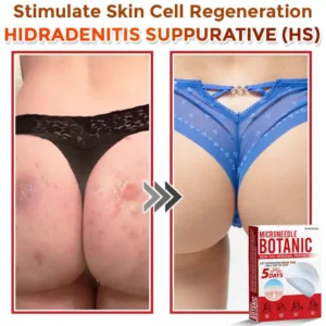 MicroNeedle Botanic Skin Tag Removal Patch - Image 6