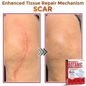 MicroNeedle Botanic Skin Tag Removal Patch - Image 9