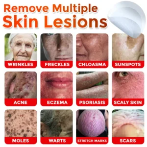 MicroNeedle Botanic Skin Tag Removal Patch - Image 11